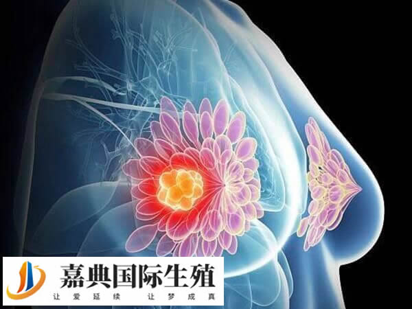 促排会不会导致乳腺癌(图1)