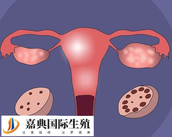 成都试管婴儿费用？附成都试管机构费用明细？(图1)